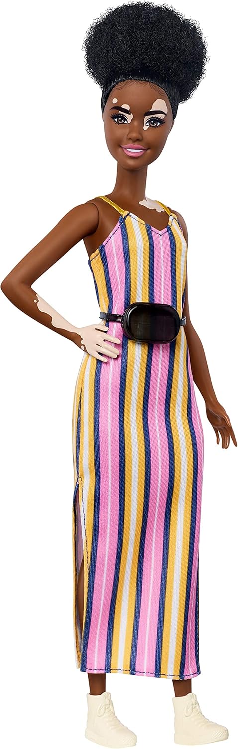 Barbie Fashionistas Vitiligo Doll with Striped Dress and Accessories (GYG08)