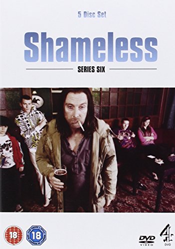 Shameless – Serien 1–7 – Drama [DVD]