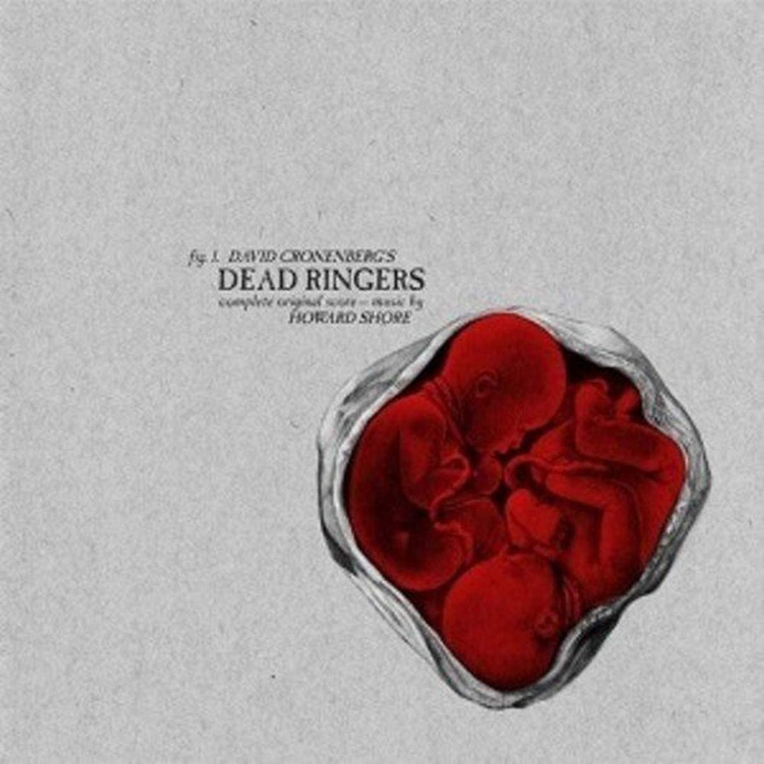 RANDY ORTIZ – DEAD RINGERS [Vinyl]